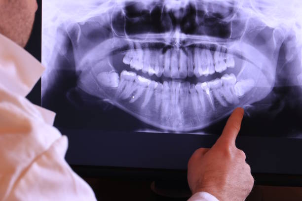 Best Mobile Emergency Dentist in Woodbine, NJ