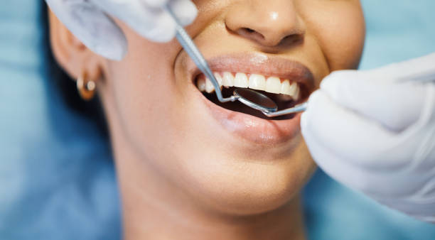 Best Broken or Cracked Tooth Emergency Dentist in Woodbine, NJ