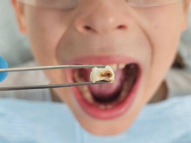 Best Urgent Dental Care for Toothache in Woodbine, NJ